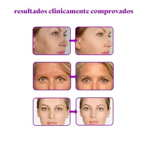 CollagenBoost - Máscara De Colágeno Que Revitalize e Renova a Pele - Direct Ofertas