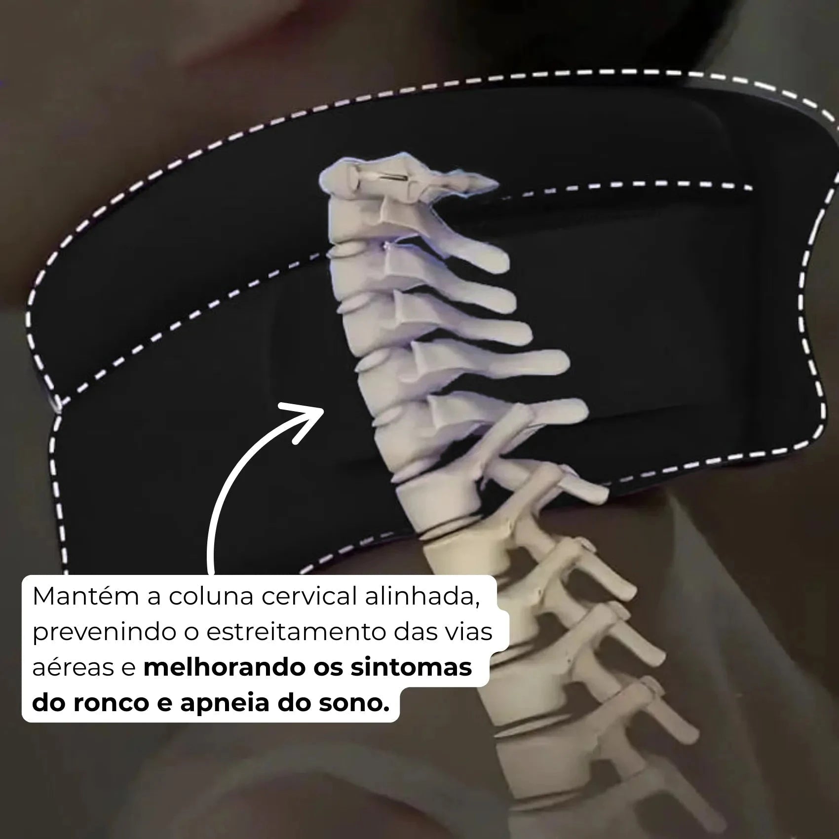 Sonare - Suporte Ergonômico para Cervical Sonare - Suporte Ergonômico para Cervical P14 Direct Ofertas
