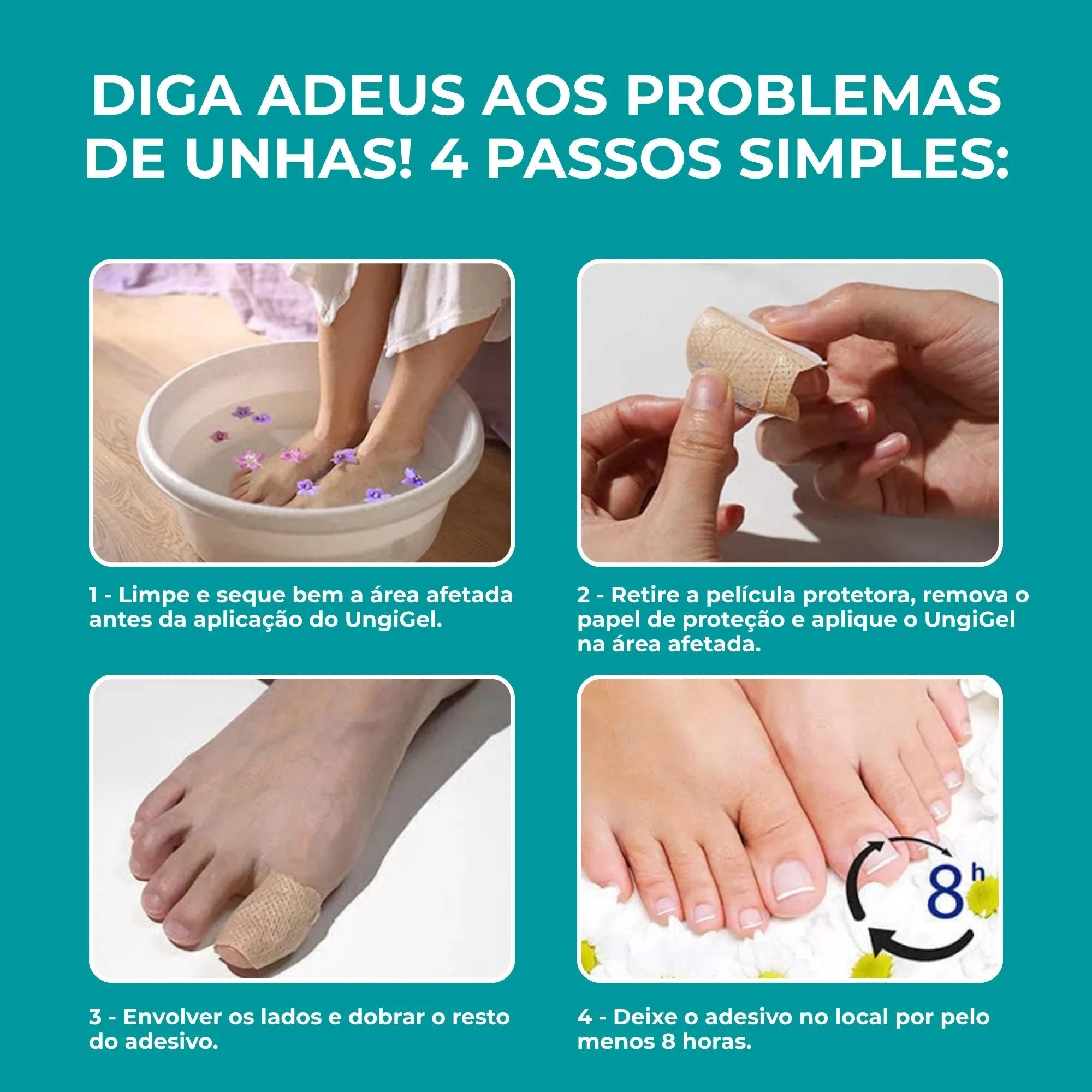 UngiGel - Adesivos para fungos UngiGel - Adesivos para fungos P11 Direct Ofertas