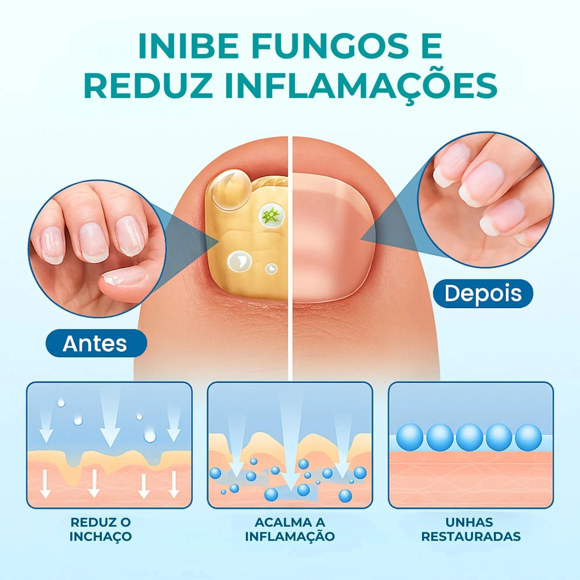 UngiGel - Adesivos para fungos UngiGel - Adesivos para fungos P11 Direct Ofertas