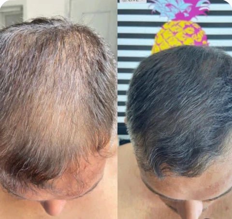 Camuflagem Capilar Profissional FixHair - Direct Ofertas