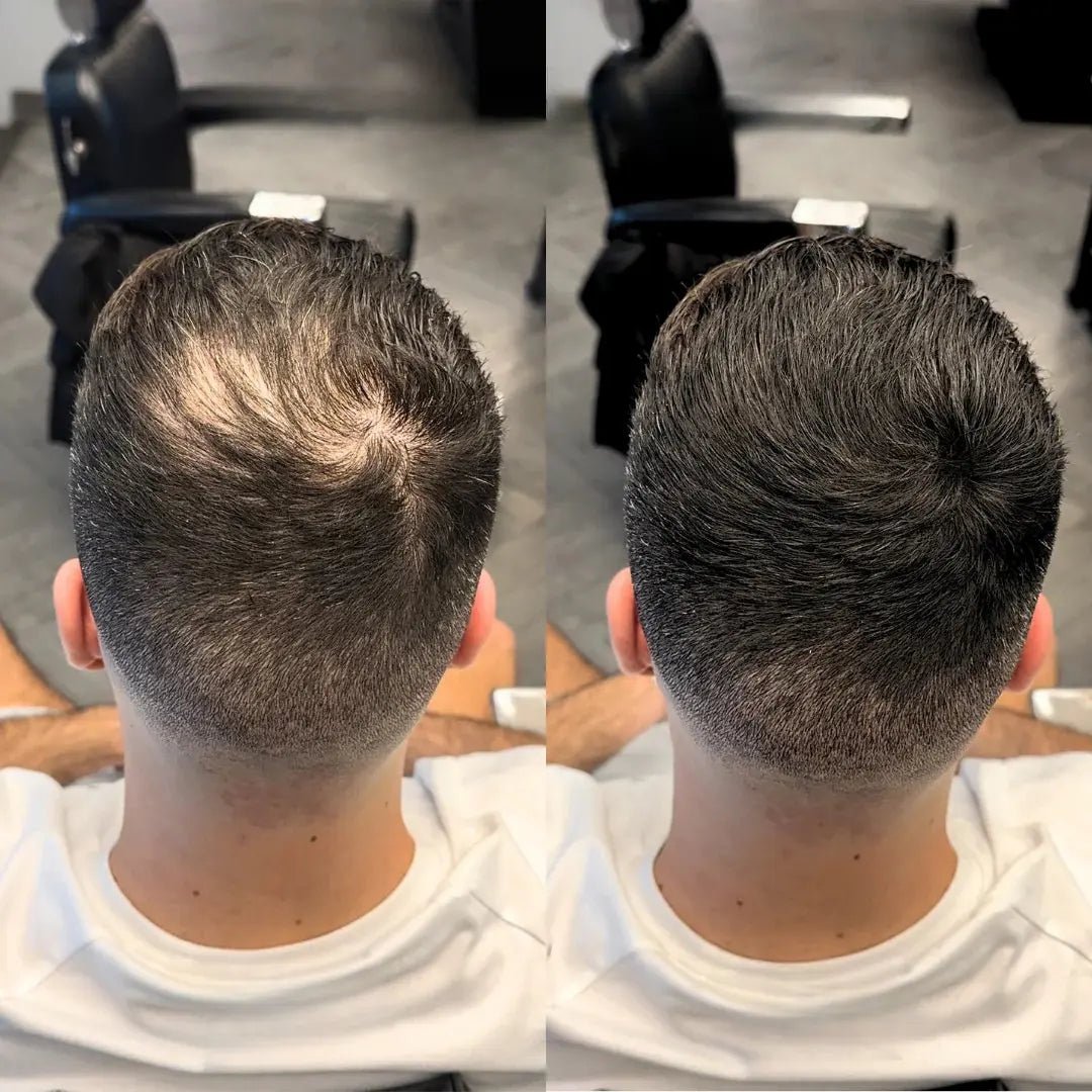 Camuflagem Capilar Profissional FixHair - Direct Ofertas