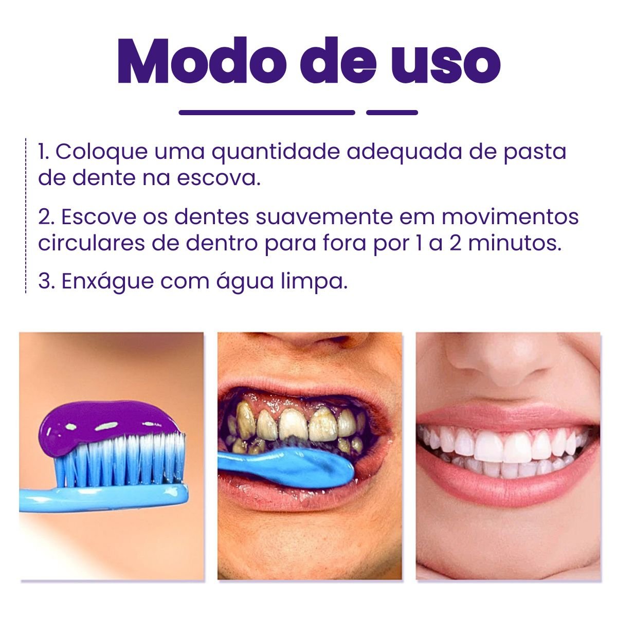 Clareador Dental iziSmile - Dentes Brancos Em Segundos [Desconto + Entrega Gratis Hoje] - Direct Ofertas