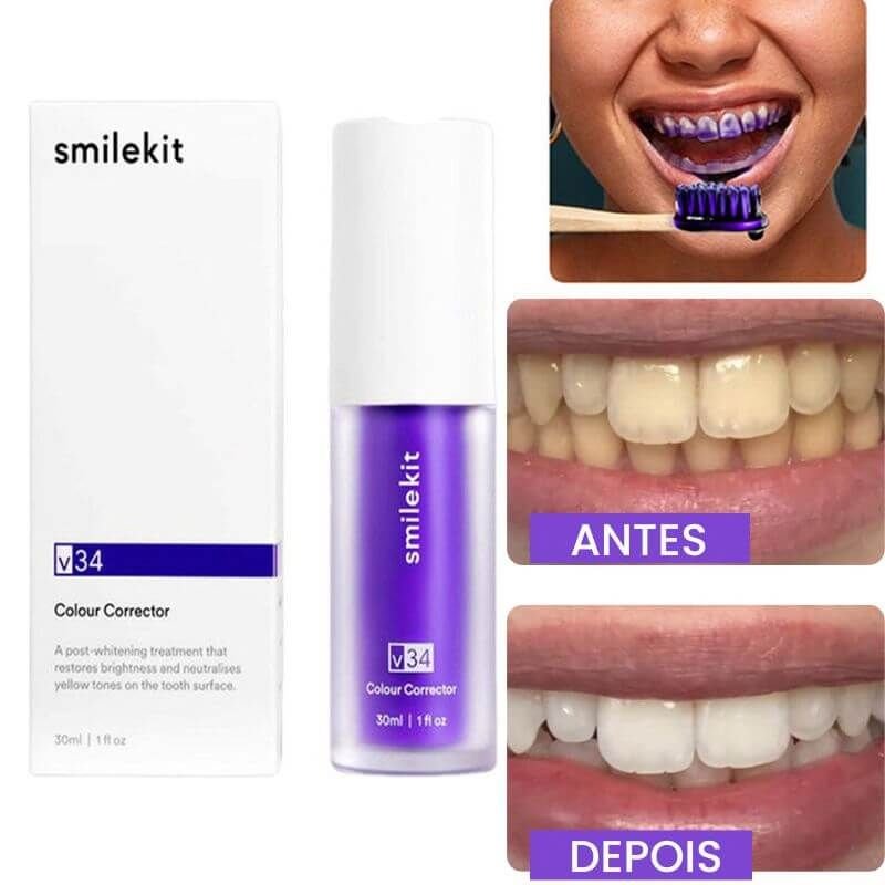 Clareador Dental iziSmile - Dentes Brancos Em Segundos [Desconto + Entrega Gratis Hoje] - Direct Ofertas