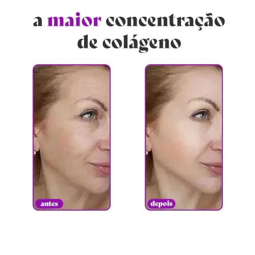 CollagenBoost - Máscara De Colágeno Que Revitalize e Renova a Pele - Direct Ofertas