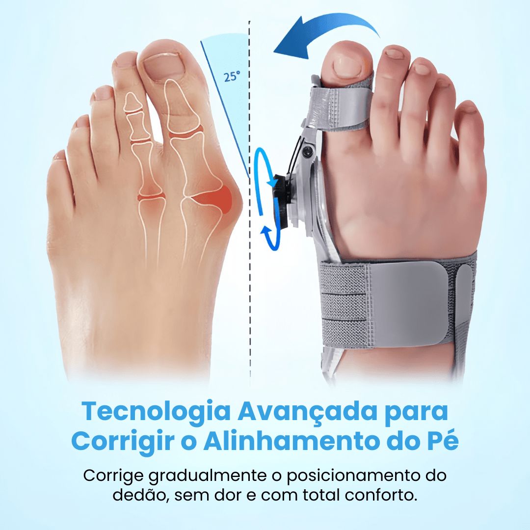 Joanetti - Corretor de Joanete - Direct Ofertas
