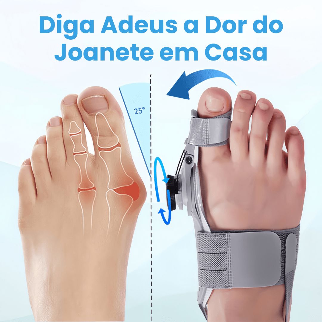 Joanetti - Corretor de Joanete - Direct Ofertas