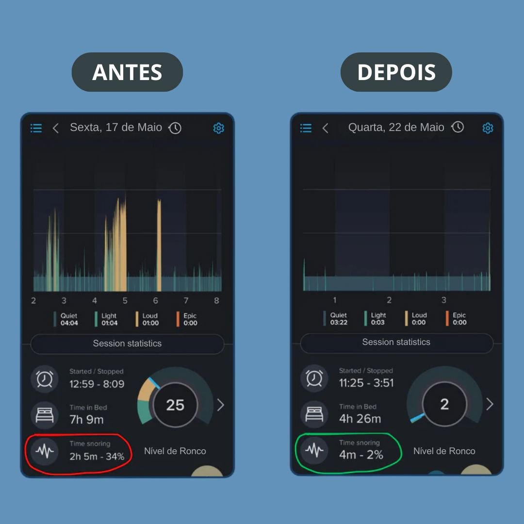 SilentFix® Solução Anti - ronco Instantânea - Direct Ofertas